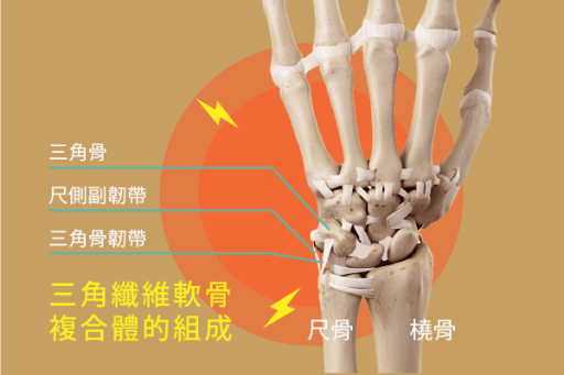 三角纖維軟骨複合體損傷