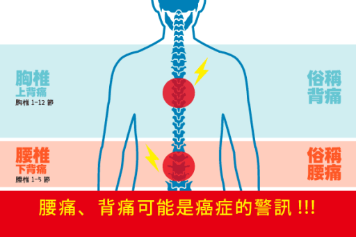 腰背痛全解析