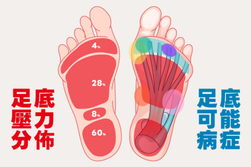 腳底痛