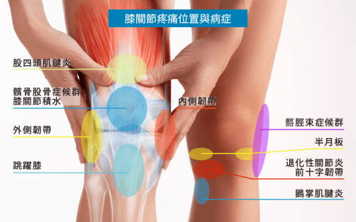 常見膝關節痛位置