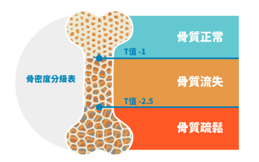 骨密度分級表