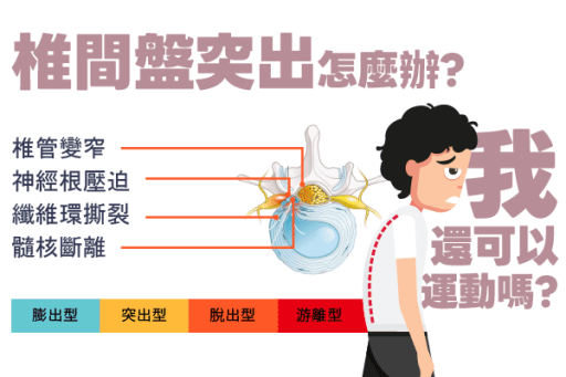 椎間盤突出怎麼辦