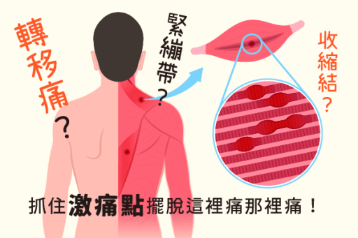 肌筋膜疼痛症候群