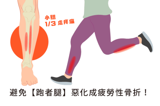 小腿痛夾脛症多久會好