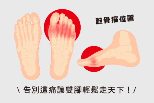 腳掌痛蹠骨痛怎麼辦？