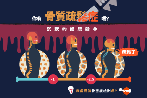 骨質疏鬆怎麼辦