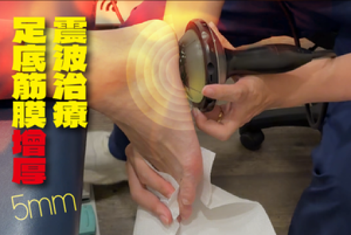 足底筋膜增厚