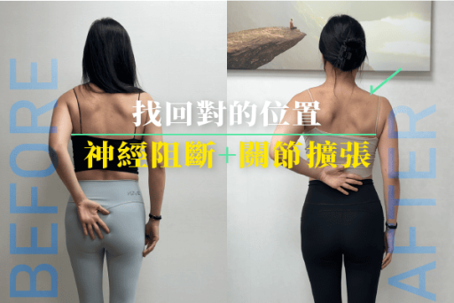 肩關節囊擴張術加乘神經阻斷