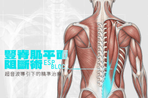 豎脊肌平面阻斷術espblock