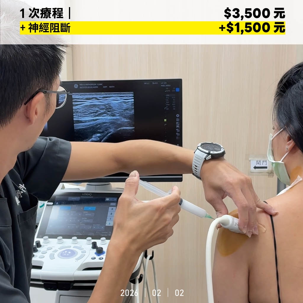 肩擴與阻斷費用