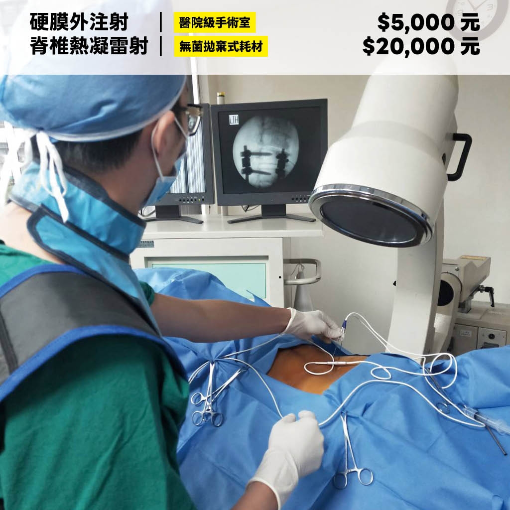 脊椎熱凝費用