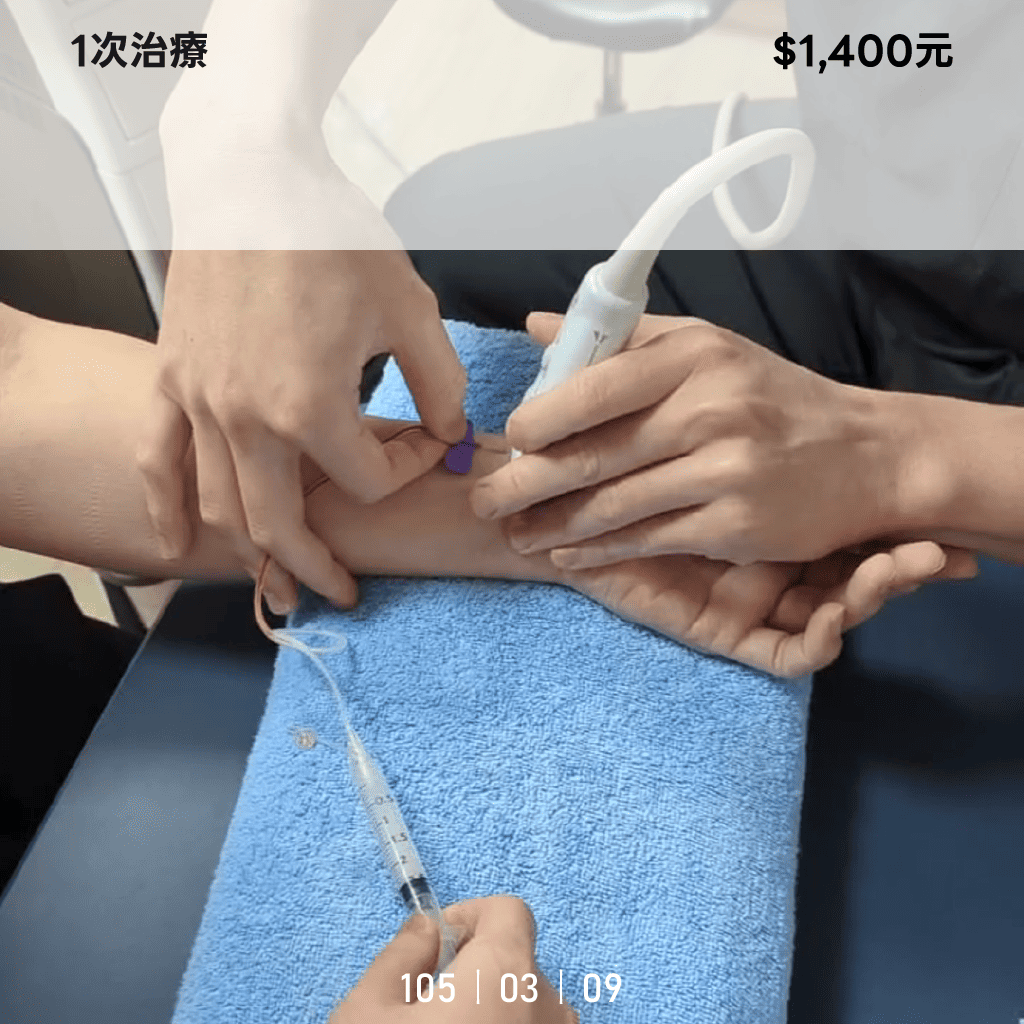 微細動脈栓塞治療費用