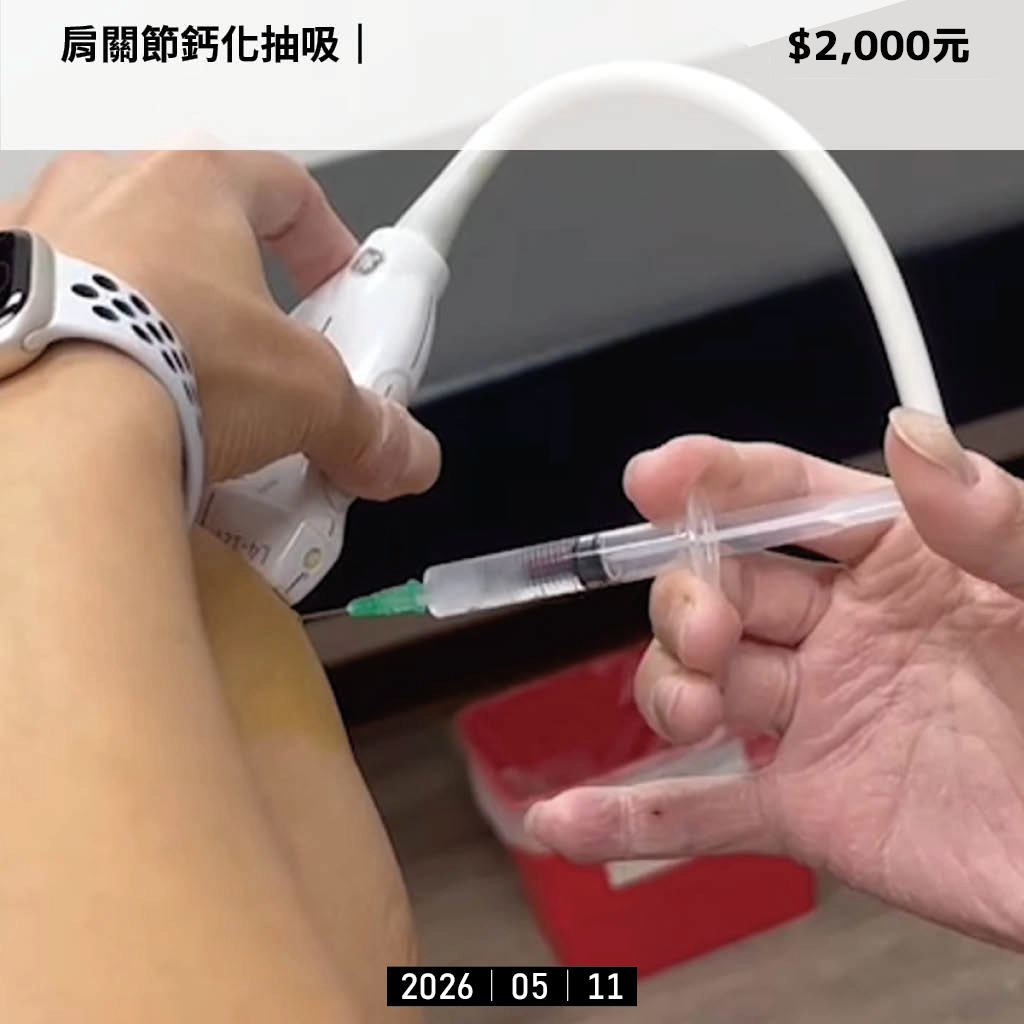 肩膀抽鈣化費用