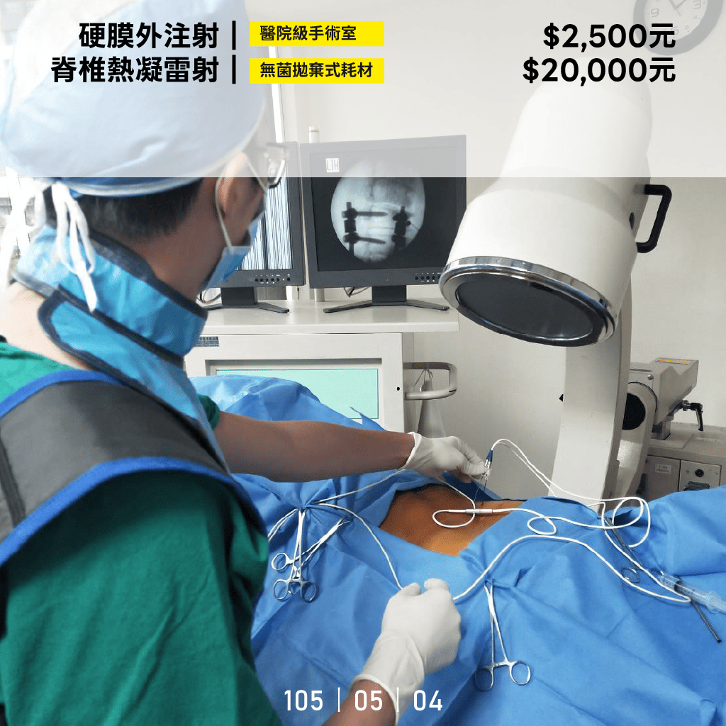 脊椎熱凝費用