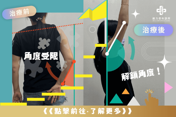 五十肩治療流程成功案例