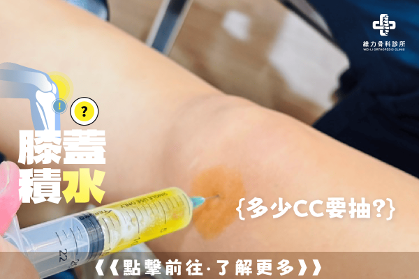 膝蓋積水怎麼辦