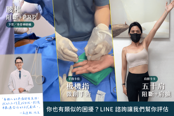 加LINE諮詢