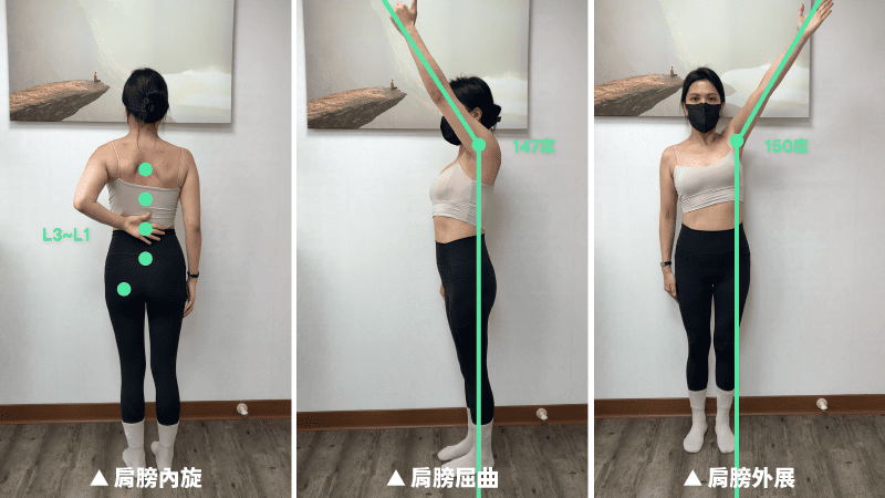 步驟七：五十肩治療成功案例
